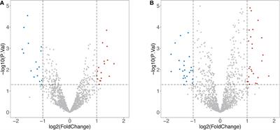 Bioinformatic analysis identifies the immunological profile of turner syndrome with different X chromosome origins